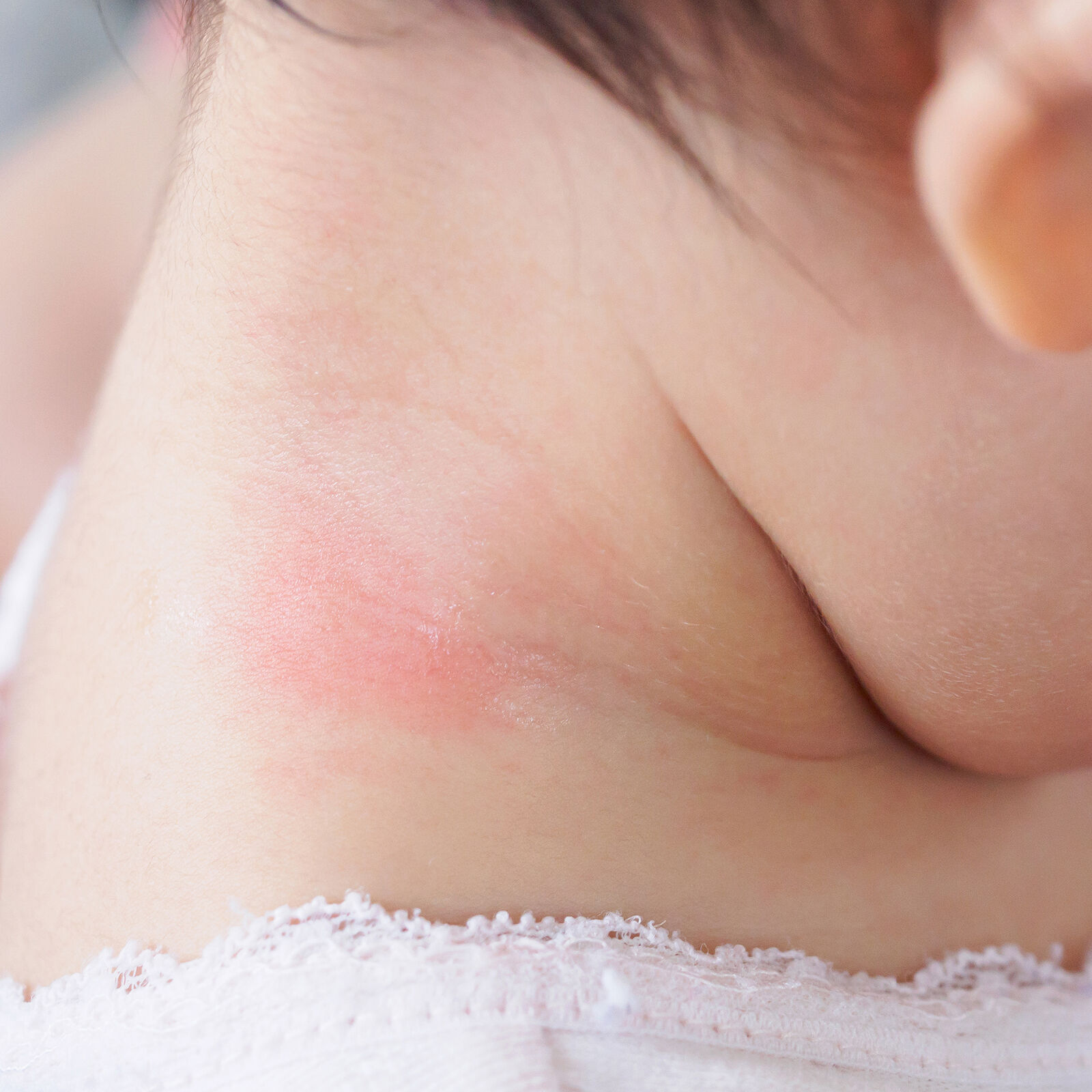 The best products for baby with dermatitis